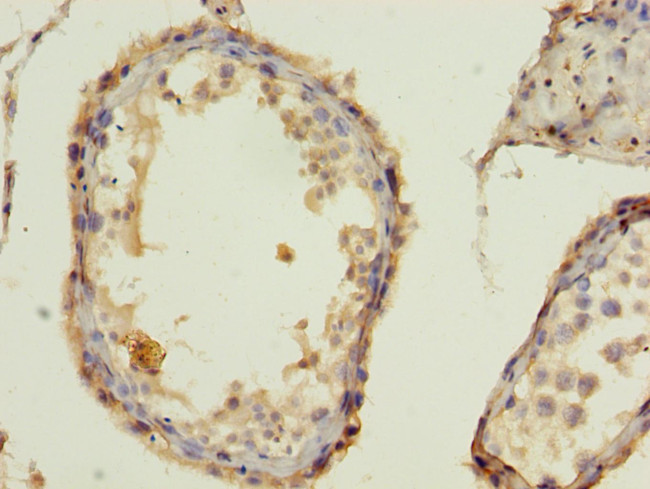 BarX1 Antibody in Immunohistochemistry (Paraffin) (IHC (P))