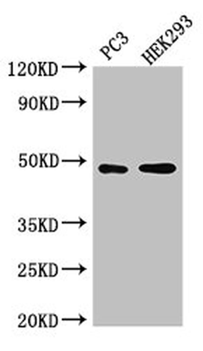 ACTR10 Antibody in Western Blot (WB)