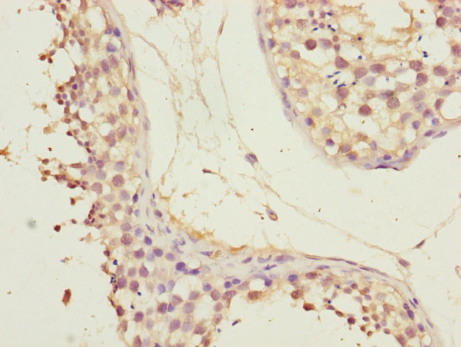 CEP72 Antibody in Immunohistochemistry (Paraffin) (IHC (P))