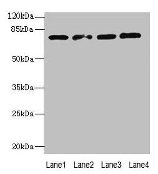 TBC1D14 Antibody in Western Blot (WB)