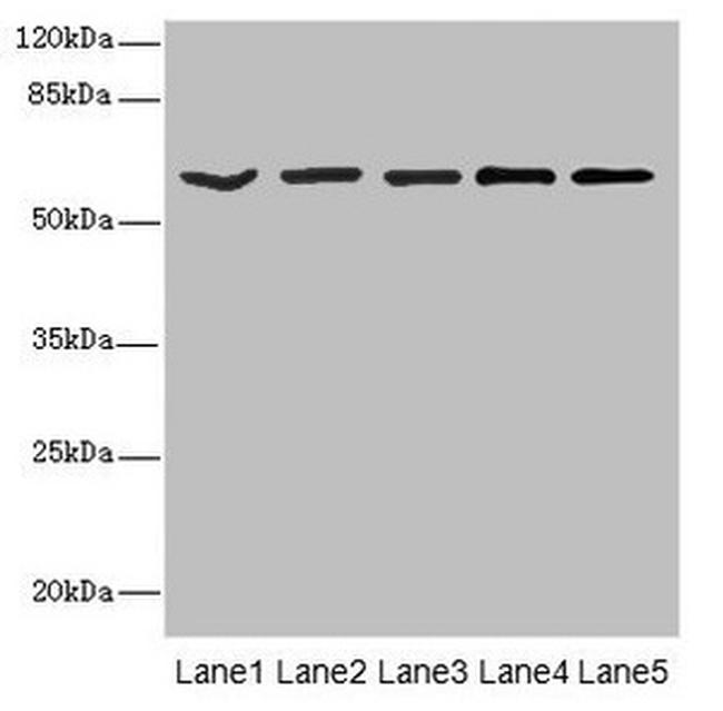 ASIC3 Antibody in Western Blot (WB)