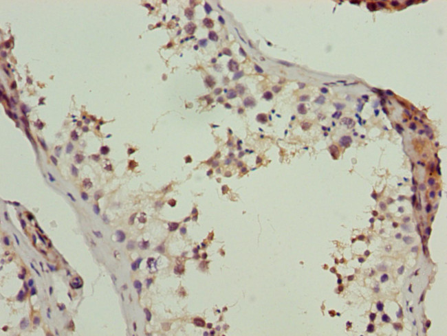 LSM7 Antibody in Immunohistochemistry (Paraffin) (IHC (P))