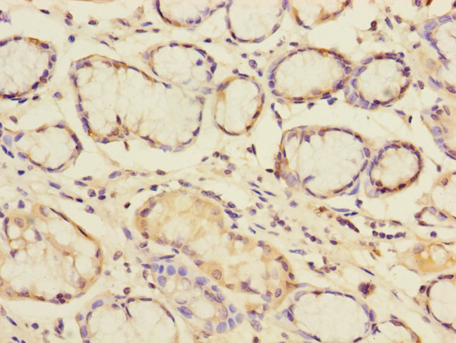 Pallidin Antibody in Immunohistochemistry (Paraffin) (IHC (P))