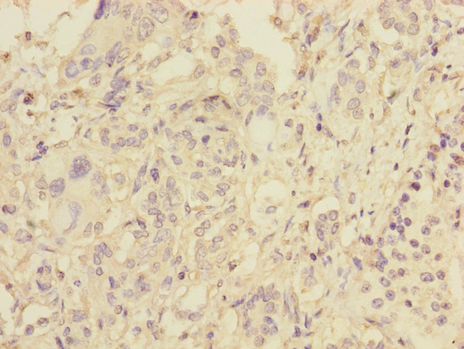 Pallidin Antibody in Immunohistochemistry (Paraffin) (IHC (P))