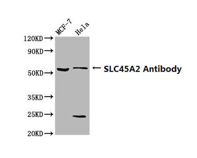 SLC45A2 Antibody in Western Blot (WB)