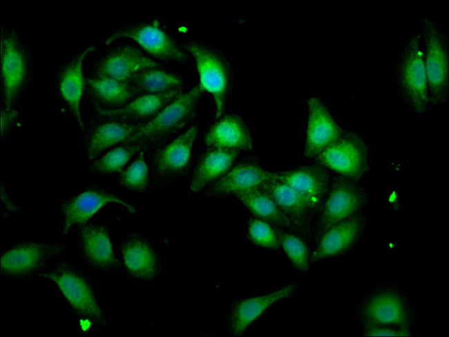 WASF3 Antibody in Immunocytochemistry (ICC/IF)