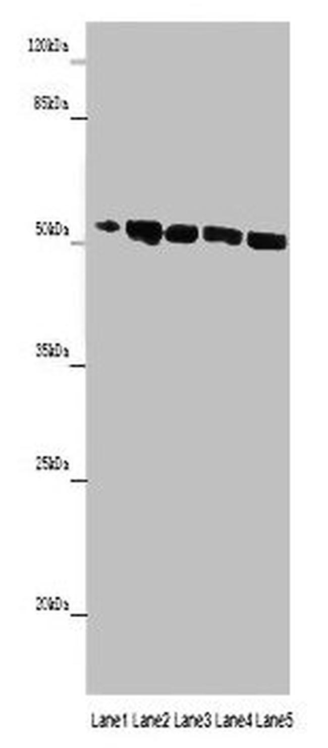 MINPP1 Antibody in Western Blot (WB)