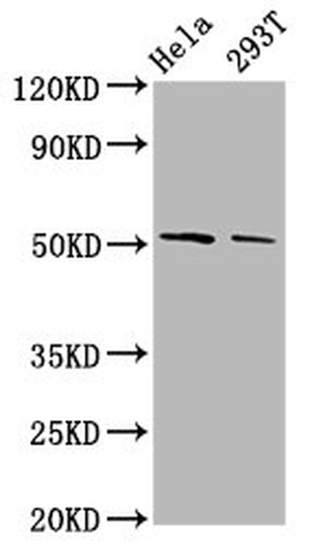 PLAGL2 Antibody in Western Blot (WB)