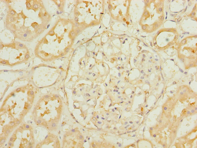 EBP1 Antibody in Immunohistochemistry (Paraffin) (IHC (P))