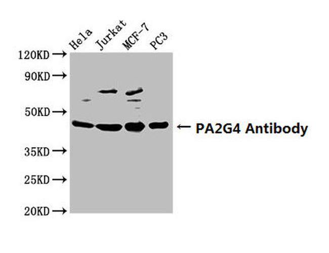 EBP1 Antibody in Western Blot (WB)