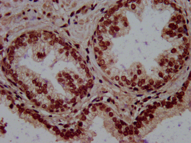 RALY Antibody in Immunohistochemistry (Paraffin) (IHC (P))