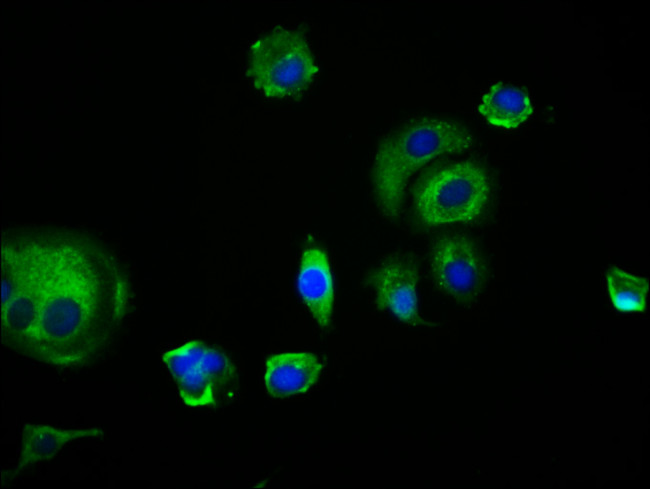 EDAR Antibody in Immunocytochemistry (ICC/IF)