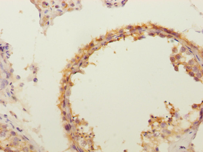 FLVCR2 Antibody in Immunohistochemistry (Paraffin) (IHC (P))