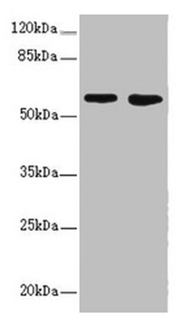 FLVCR2 Antibody in Western Blot (WB)