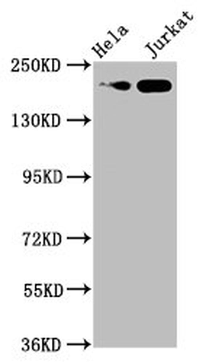 MYH2 Antibody in Western Blot (WB)