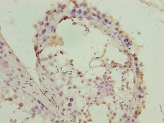 FZR1 Antibody in Immunohistochemistry (Paraffin) (IHC (P))