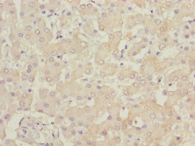 B9D1 Antibody in Immunohistochemistry (Paraffin) (IHC (P))