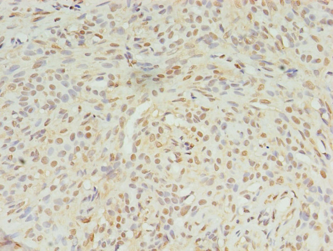 STK38L Antibody in Immunohistochemistry (Paraffin) (IHC (P))