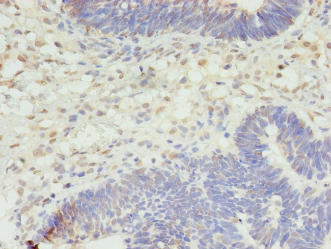 STK38L Antibody in Immunohistochemistry (Paraffin) (IHC (P))