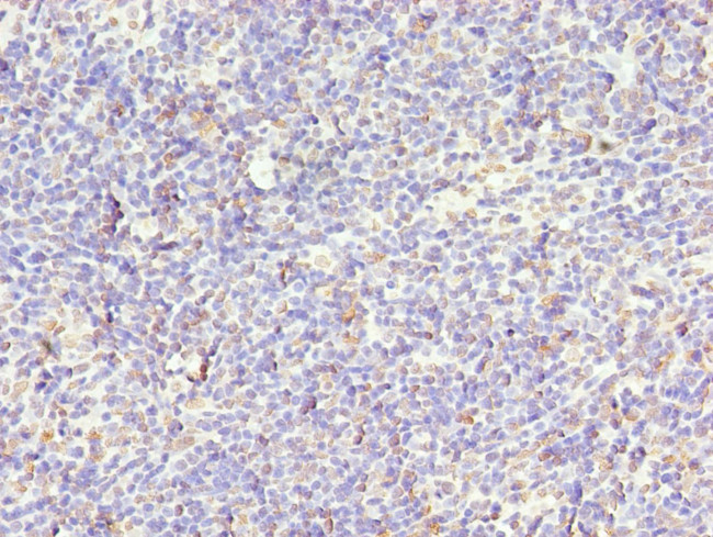 STK38L Antibody in Immunohistochemistry (Paraffin) (IHC (P))