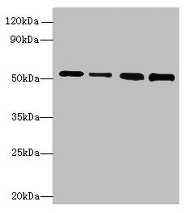 STK38L Antibody in Western Blot (WB)