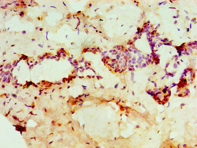 PADI2 Antibody in Immunohistochemistry (Paraffin) (IHC (P))