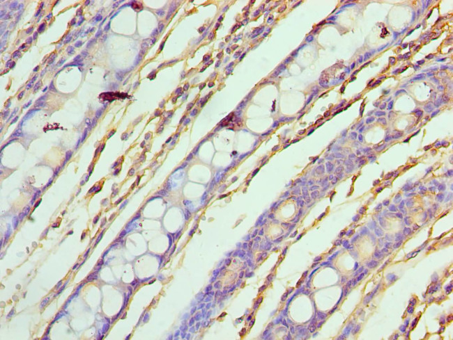 ASF1A Antibody in Immunohistochemistry (Paraffin) (IHC (P))