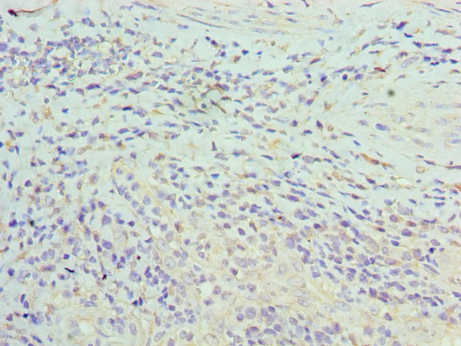 ASF1A Antibody in Immunohistochemistry (Paraffin) (IHC (P))