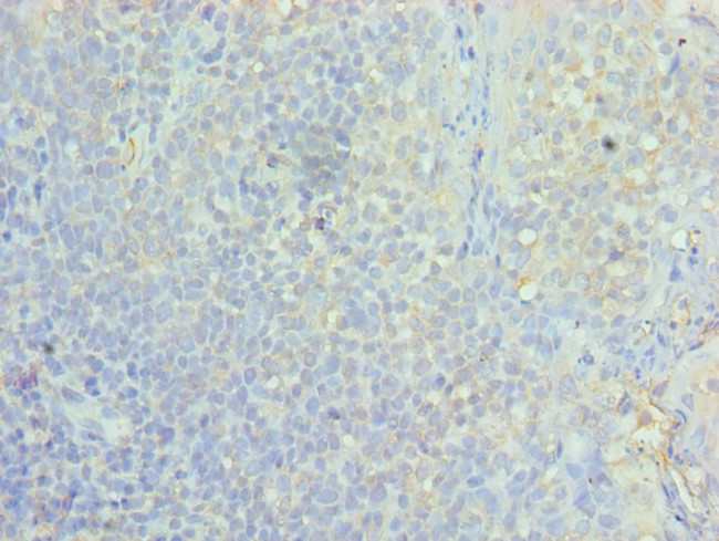 ASF1A Antibody in Immunohistochemistry (Paraffin) (IHC (P))