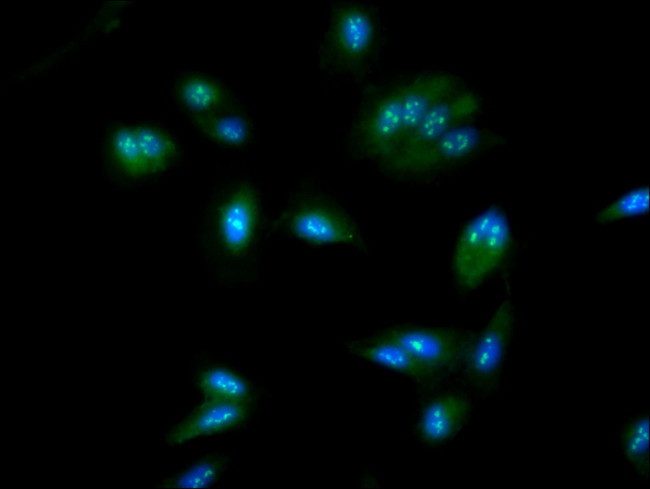 NOP58 Antibody in Immunocytochemistry (ICC/IF)