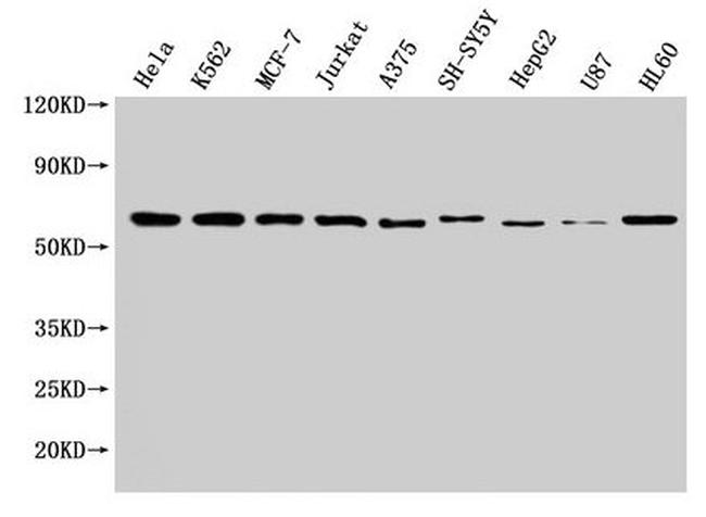 NOP58 Antibody in Western Blot (WB)