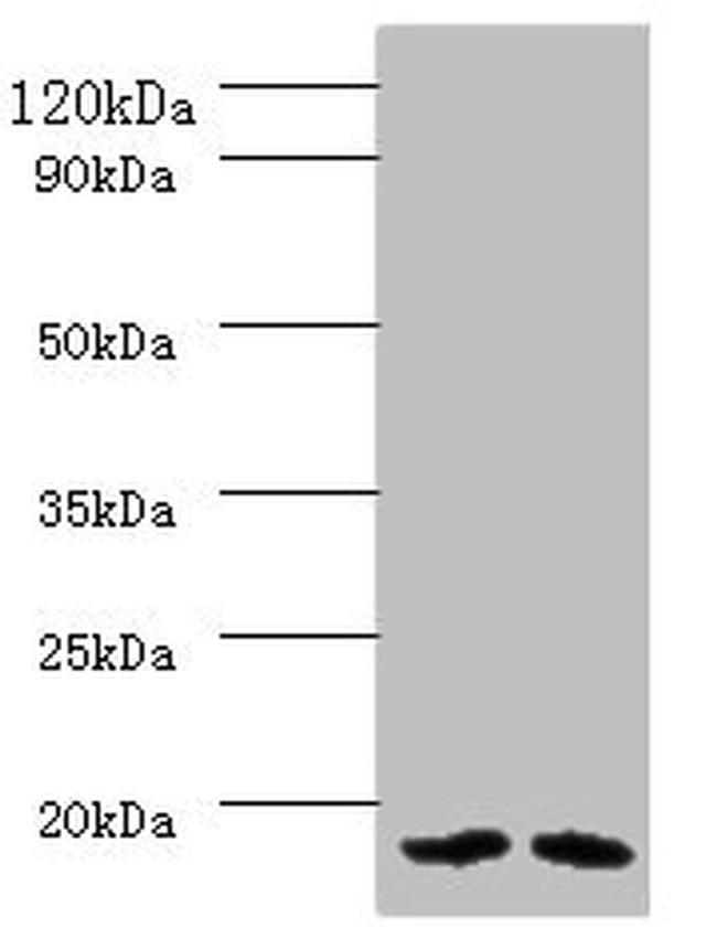 PAM16 Antibody in Western Blot (WB)