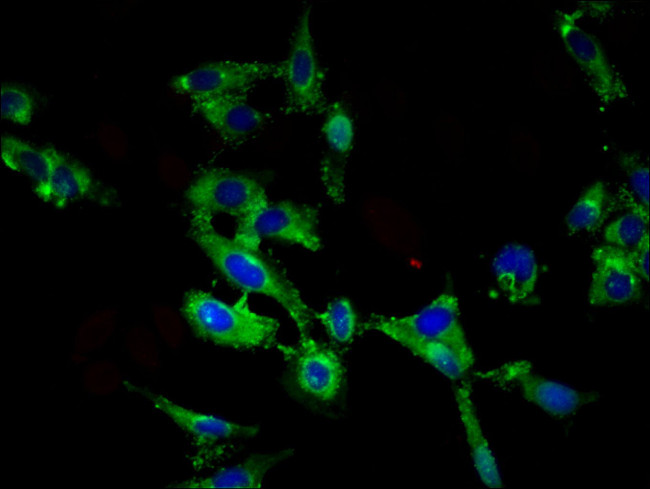 ROBO1 Antibody in Immunocytochemistry (ICC/IF)