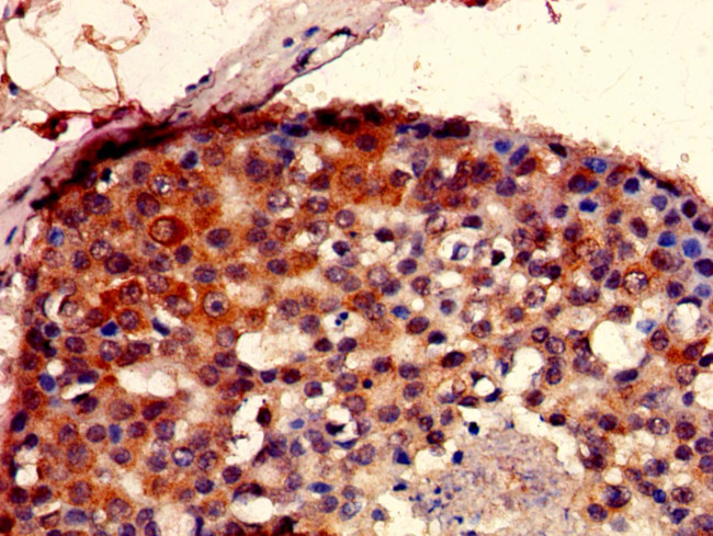 SEC23IP Antibody in Immunohistochemistry (Paraffin) (IHC (P))