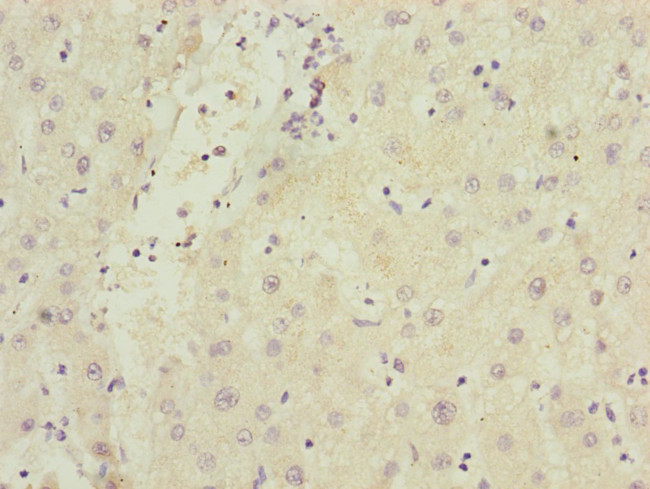 SAMM50 Antibody in Immunohistochemistry (Paraffin) (IHC (P))