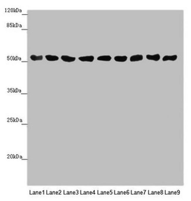 SAMM50 Antibody in Western Blot (WB)