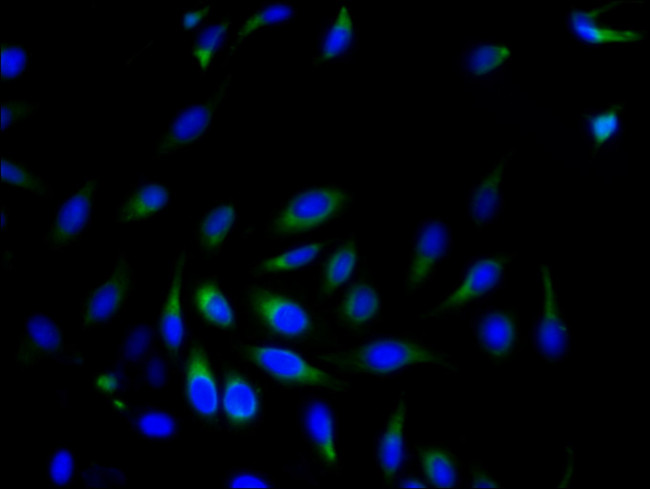 SRPRB Antibody in Immunocytochemistry (ICC/IF)