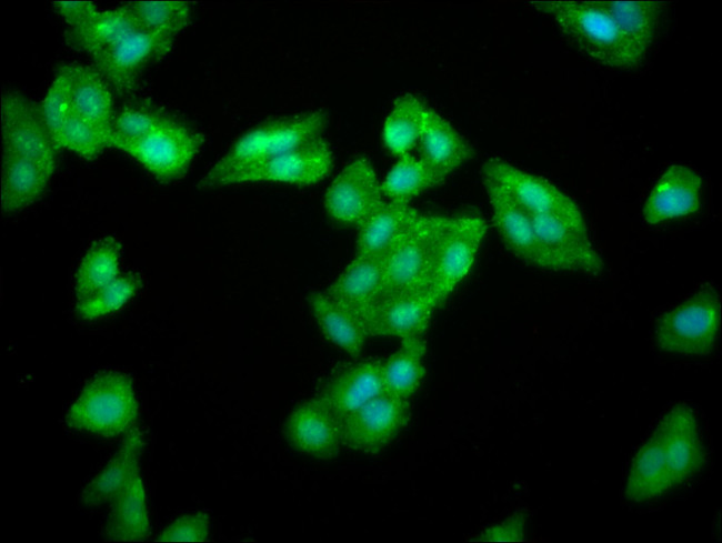 LAS1L Antibody in Immunocytochemistry (ICC/IF)