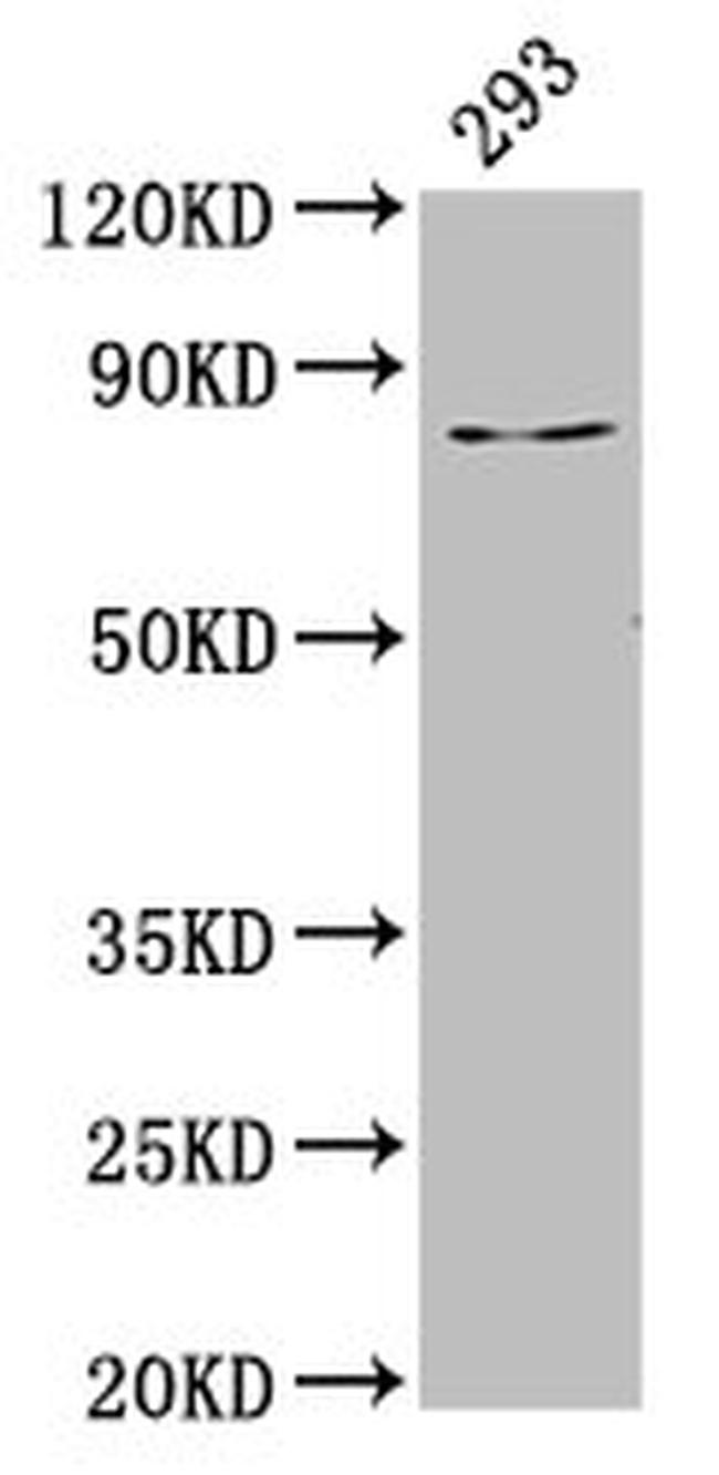 LAS1L Antibody in Western Blot (WB)