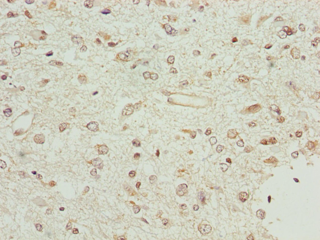 BCS1L Antibody in Immunohistochemistry (Paraffin) (IHC (P))