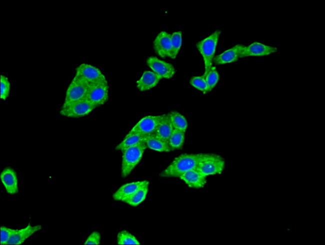 BTRC Antibody in Immunocytochemistry (ICC/IF)