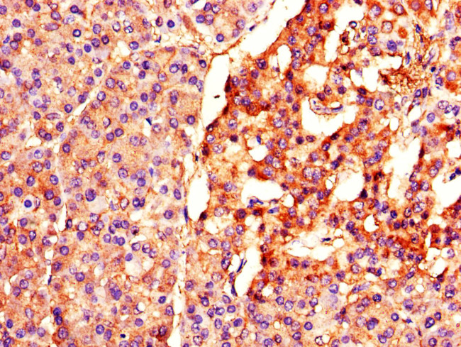 BTRC Antibody in Immunohistochemistry (Paraffin) (IHC (P))