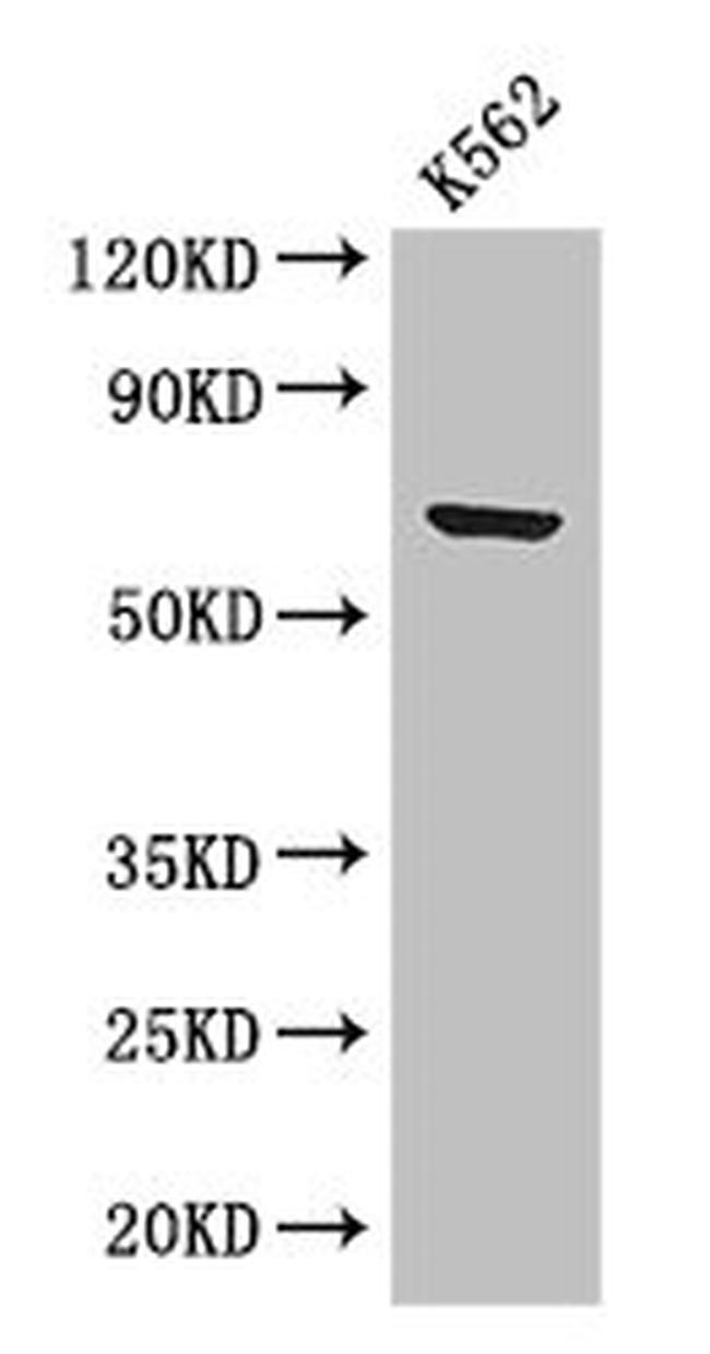 BTRC Antibody in Western Blot (WB)