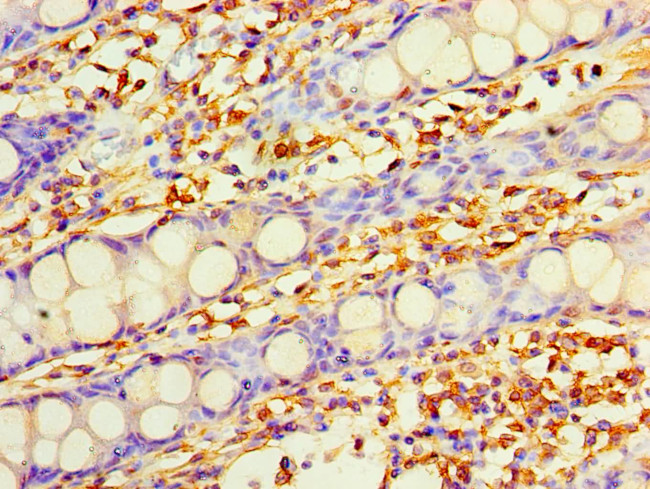 DHRS7 Antibody in Immunohistochemistry (Paraffin) (IHC (P))