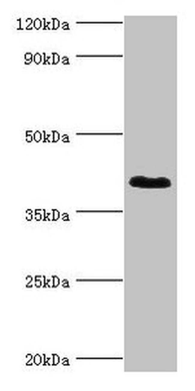 DHRS7 Antibody in Western Blot (WB)