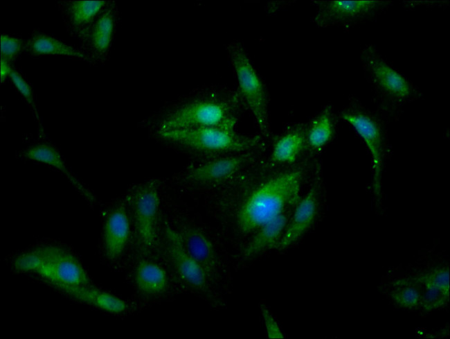 SSX2IP Antibody in Immunocytochemistry (ICC/IF)