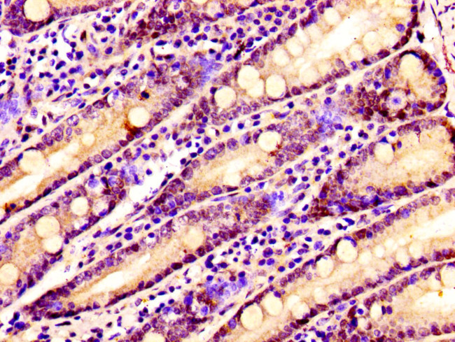 SSX2IP Antibody in Immunohistochemistry (Paraffin) (IHC (P))