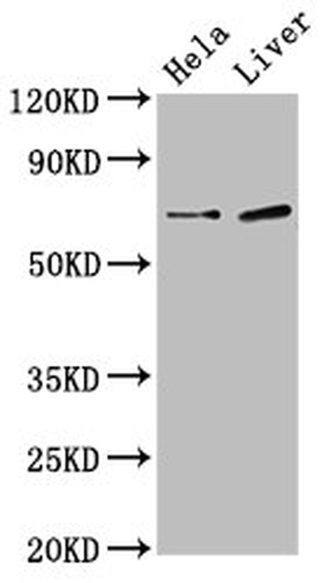 SSX2IP Antibody in Western Blot (WB)