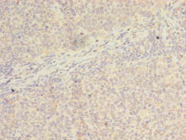 WDR37 Antibody in Immunohistochemistry (Paraffin) (IHC (P))