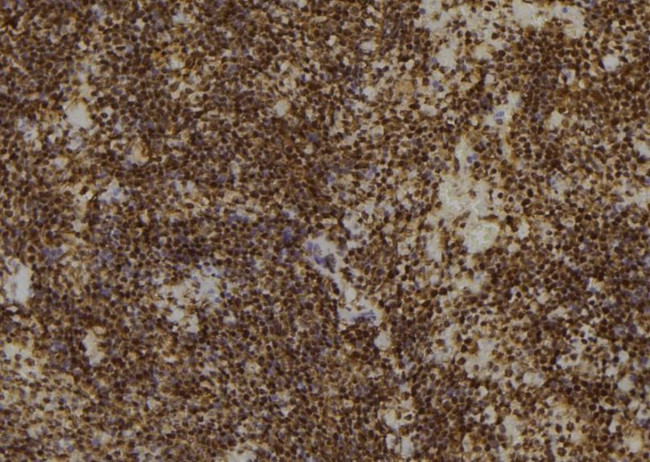 Phospho-CDC25A (Ser76) Antibody in Immunohistochemistry (Paraffin) (IHC (P))